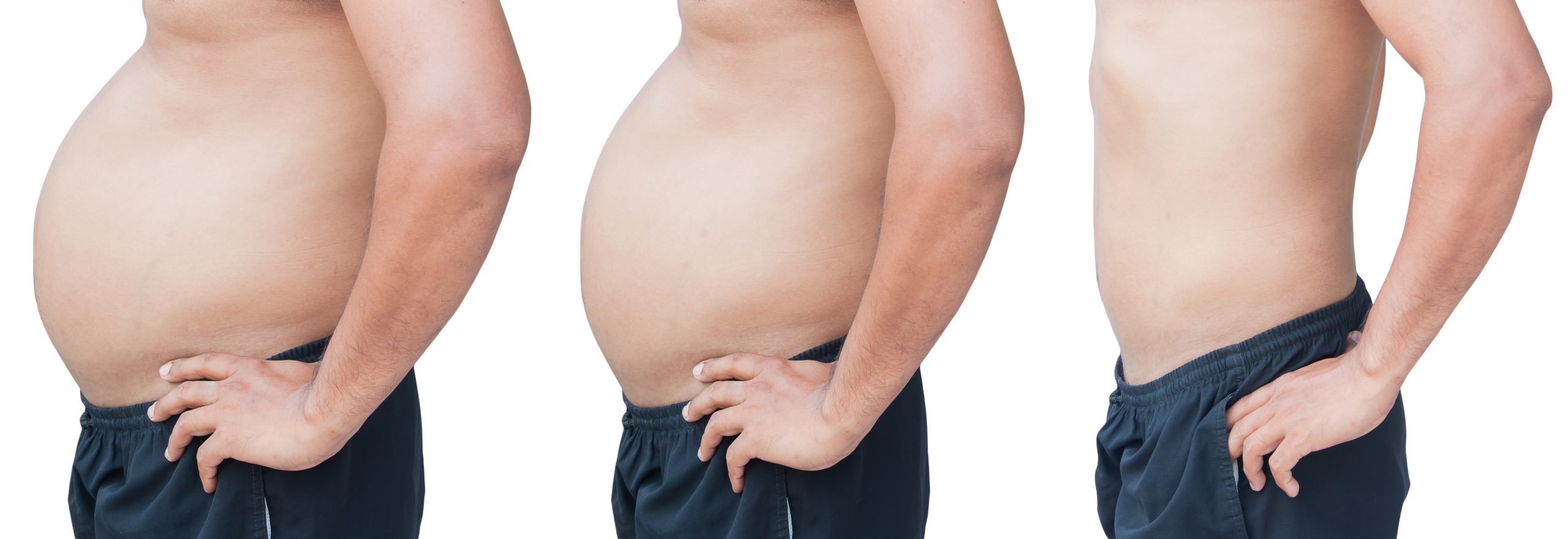 + Información sobre obesidad